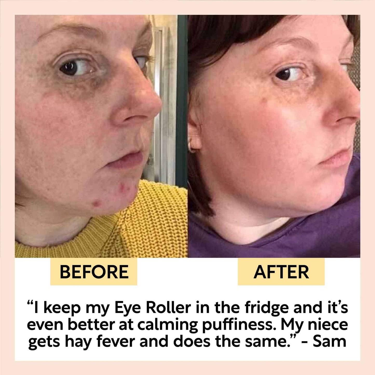 UpCircle Eye Roller